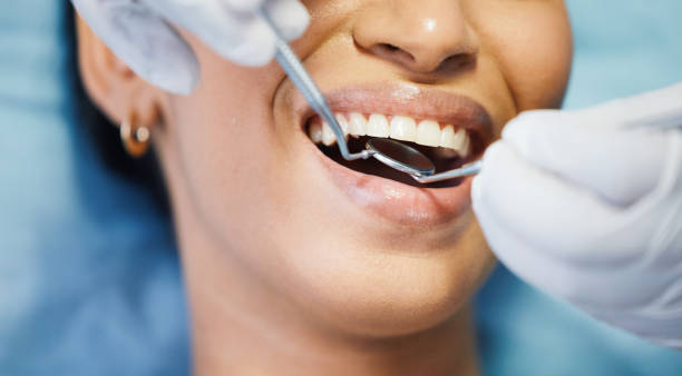 Best Emergency Dental Care for Abscessed Tooth in Balcones Heights, TX